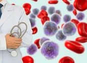 ¿QUÉ ES LA LEUCEMIA MIELOIDE AGUDA? LA PRIMERA CON MÁS CASOS NUEVOS CADA AÑO
